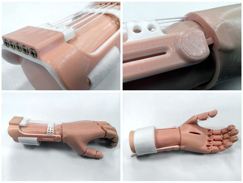 Индивидуальные протезы пальцев из силиконовых материалов
